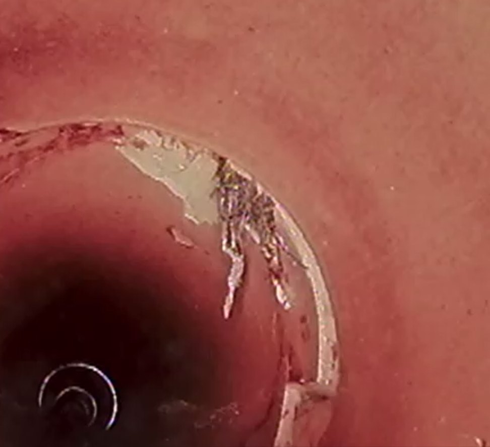 CCTV drain survey still showing a broken section and mineral deposits inside an earthenware sewer